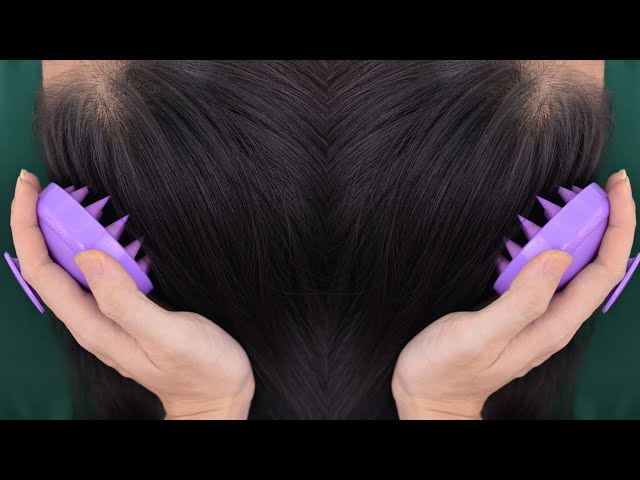 ASMR Scalp Massage On Real Person Tingling For Headache Relief ( No Talking )