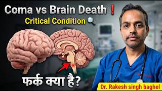 How to tell if the patient is in a coma or brain death? How to differentiate between coma and bra...