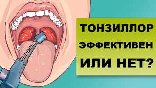 ПОМОЖЕТ ЛИ МНЕ ТОНЗИЛЛОР? Все о промывании миндалин