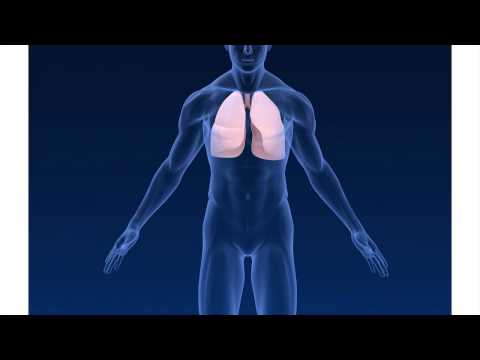 Pulmonary Embolism