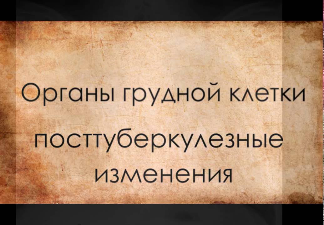 Посттуберкулезные изменения