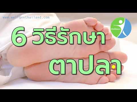 6วิธีรักษาตาปลา WELLGENTHAILAND