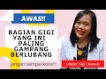 Bagian gigi ini gampang sekali berlubang dan rentan karies gigi | Dokter Gigi Channel