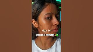 sea beauty papaya ✅👈#skincare #viralskincare #skincareroutine #explore #koreanbeauty #shorts