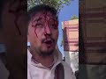 Taliban Beat Australian Citizen Before Assaulting Him Again On Camera - 2021 US Withdrawal