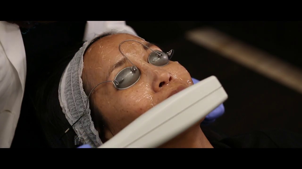 Laser Treatments in San Diego: Carmel Valley Facial Plastic Surgery