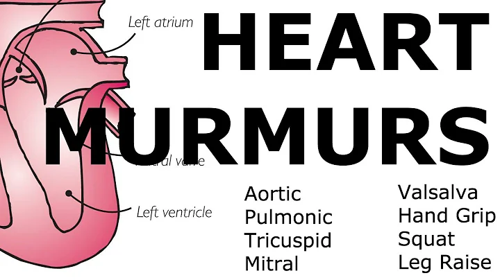 Unraveling the Mysteries of Heart Murmurs: Locations, Maneuvers, and Buzzwords