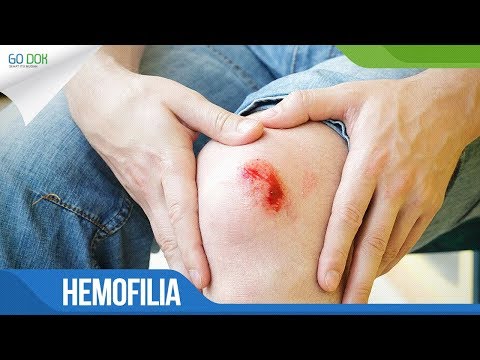 Video: Menyembuhkan Hemofilia A Dengan Insersi Ektopik F8 Yang Diperantarai NHEJ Pada Tikus