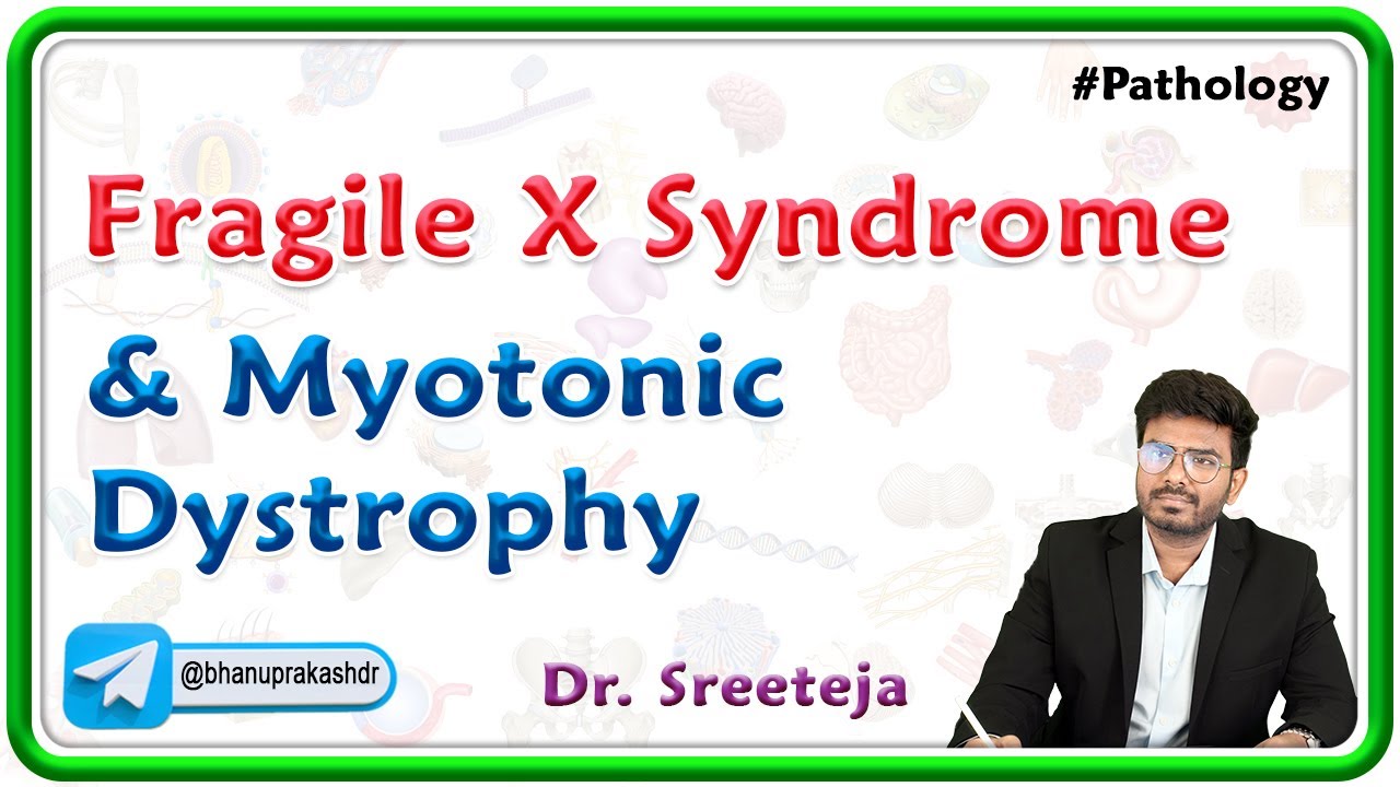 7: Fragile X Syndrome And Myotonic Dystrophy : USMLE Step 1 Pathology