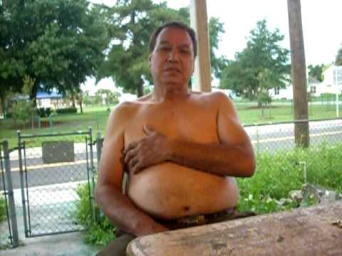 pie plano pdf Curacion de Hombro Testimonio Santiago: Plant Cyt Fla. USA.