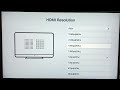 Jio Set Top Box (STB) | How to Change Screen Resolution 4K, FULL HD, HD