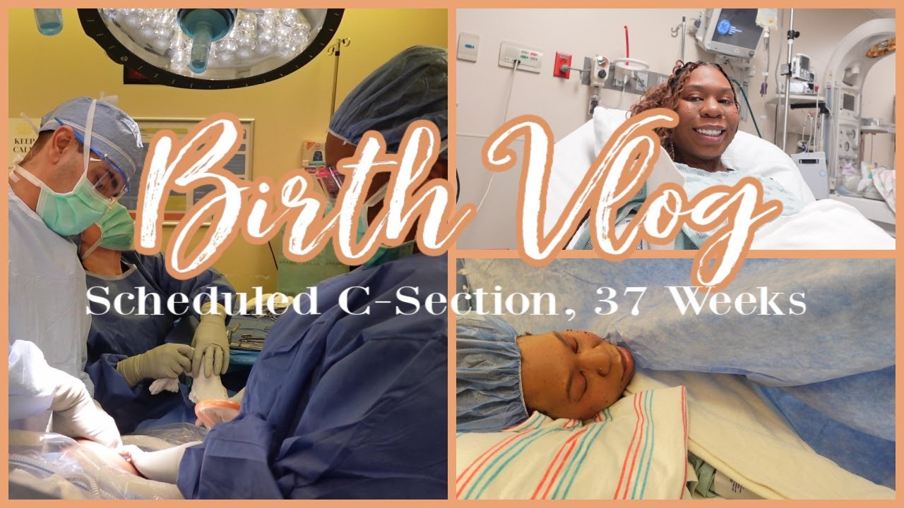 C Section At 37 Weeks: The Essential Guide