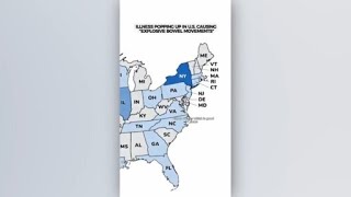 CDC seeks source of parasitic outbreak linked to 'explosive' diarrhea in multiple states, including
