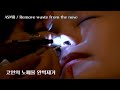 ASMR Removing Waste From The Nose Cleaning The Nose In China ASMR Removing Waste From The Nose Cleaning The Nose In China