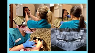 20th Braces Visit || Adding A Bracket,17 Mth Comparison/Panoramic & 3D X-Rays
