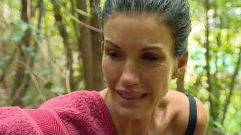 Janice Injures Herself - Part 1 | I'm A Celebrity....