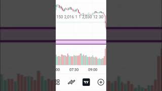 Gold Analysis 😳 Market Upar Jayegi Ya Gir Jayegi? Sach Samne Aa Gaya!