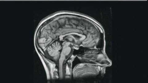 Energy Functionals: Choices and Consequences For Medical Image Segmentation