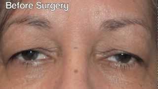 Dr. Hui Surgeries