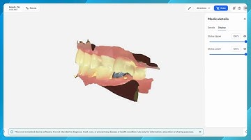 DS Core General Features - Status & Treatment Scan