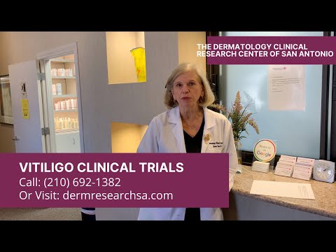 Vitiligo Clinical Trials in San Antonio at Dermatology Clinical Research Center of San Antonio