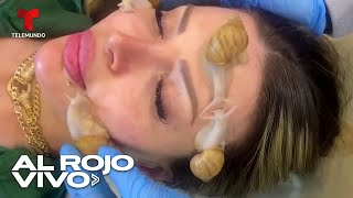 Usan Baba De Caracol Para Nutrir Y Rejuvenecer La Piel Como Tratamiento En Un Spa De Siria