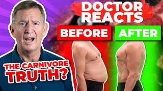 REVIEWING Mark Sisson: The Truth About The Carnivore Diet Interview (HIGHLIGHTS) - Doctor Reacts