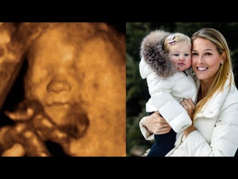 Morgan Miller Says Daughter's Angel Appeared in Son's Ultrasound