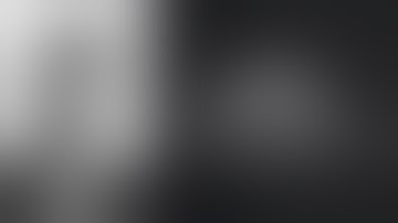 Dr Jacopo Conteduca, MD - First MTP Arthrodesis