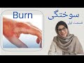هر آنچه درباره سوختگی باید بدانیم قسمت اول 
