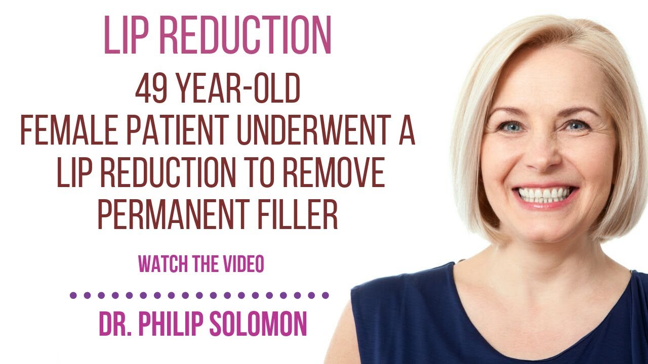 Lip Reduction Removal Of Permanent Filler Dr. Philip Solomon Toronto YouTube