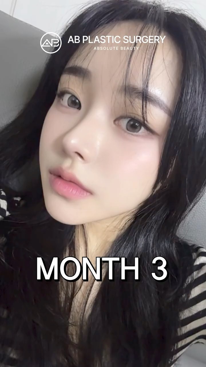 Why Korea Is Known for Nose & Facial Contouring #shorts