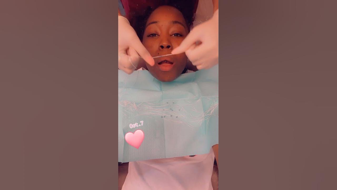 Rubber bands for my braces first appointment YouTube