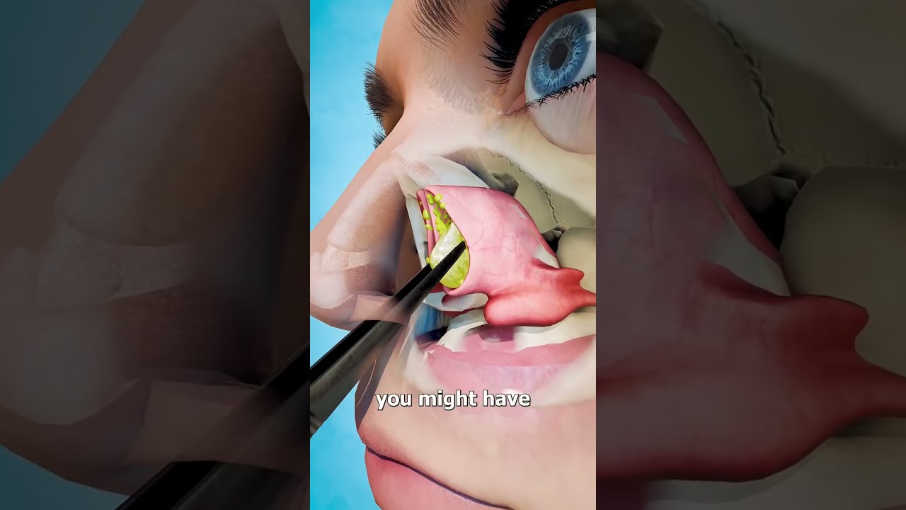 If You Have A Blockage In Your Nose Funny
