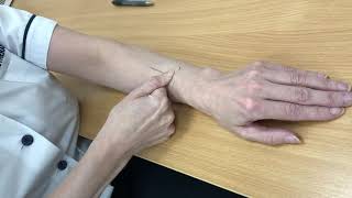 Scar management post cardiac surgery