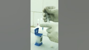 #CBNAAT EQA .My upcoming Video. Take a look.