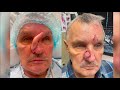 Skin Cancer Awareness Month - Jay Garrens's Story