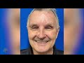 Skin Cancer Awareness Month - Jay Garrens's Story