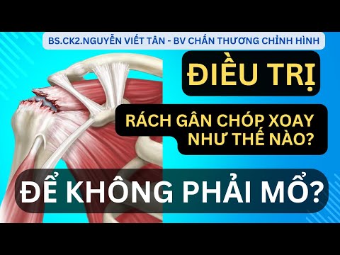 ĐIỀU TRỊ RÁCH GÂN CHÓP XOAY NHƯ THẾ NÀO ĐỂ KHÔNG PHẢI MỔ? - Khớp Việt Official