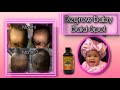 How To Regrow Baby Bald Spot| Prevent Balding & Promote Hair Growth| Regimen  Demonstration