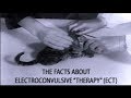 Electroconvulsive therapy the facts about ect