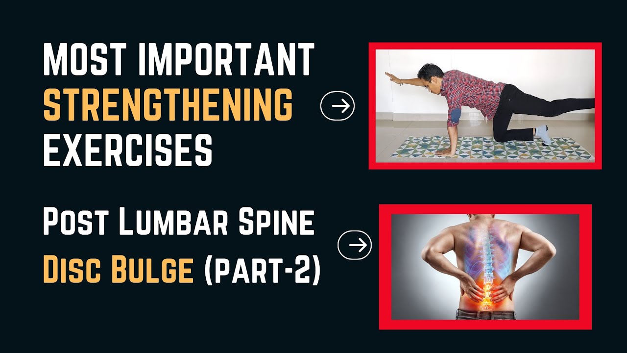 MOST EFFECTIVE AND IMPORTANT EXERCISES POST LUMBAR SPINE DISC BULGE