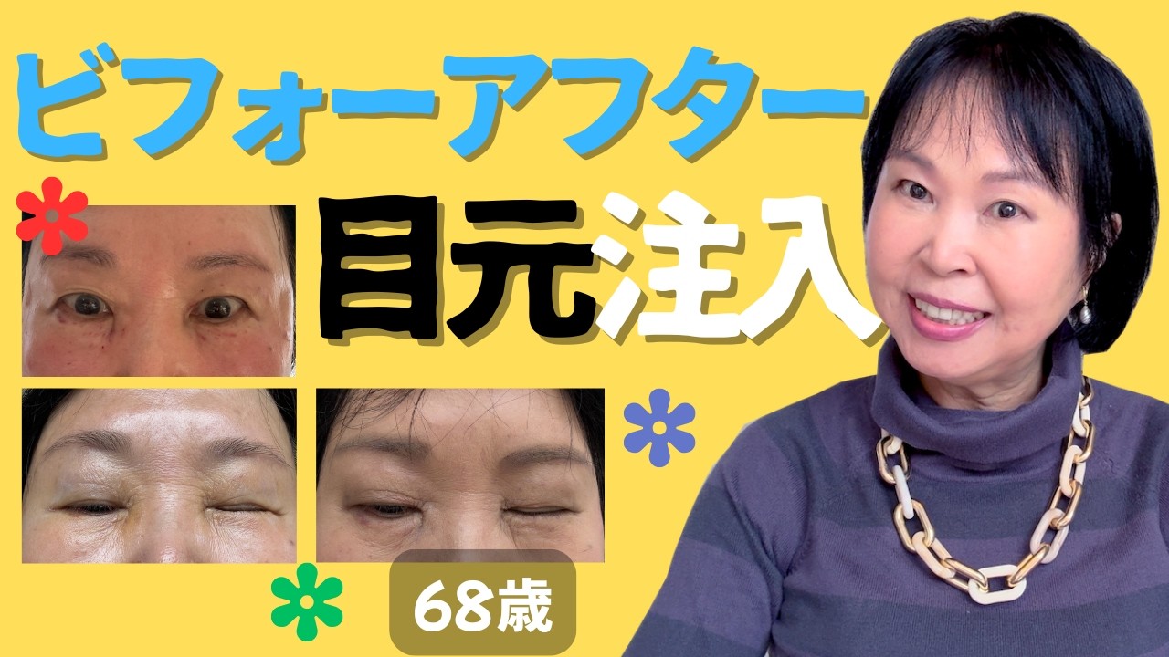 プルリアル目元ビフォー・アフター：質問にもお答え