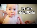 CUTE BABY WITH PNEUMONIA | Dr. Paul