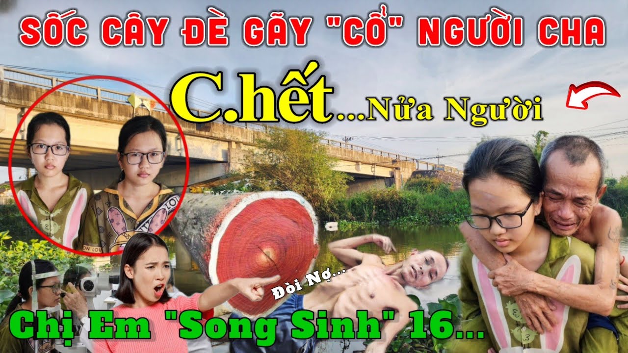 Sốc Kết Quả Khám Mắt, Chị Em 16.T Chăm sóc, Thay Tã, Người Cha Nằm 