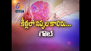 Gout Disease And Treatment | Sukhibhava | 2nd August 2019 | ETV Andhra Pradesh