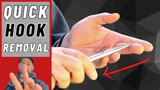 Stop! Don't pull that hook out until you watch this!