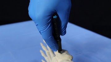 DynaClip Surgical Technique Demonstration