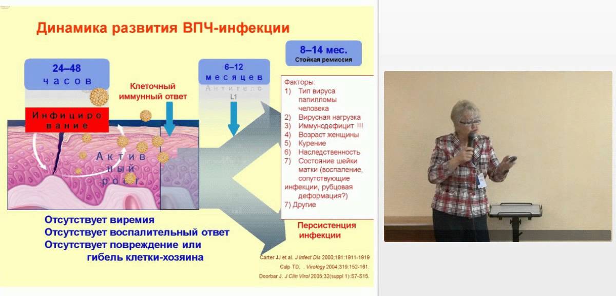 Особенности лечения заболеваний обусловленных папилломавирусной инфекцией