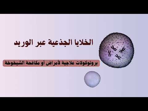 الكثير يظن أن كبسولات الخلايا الجذعية تغني عن العلاج الوريدي الحقيقة لا